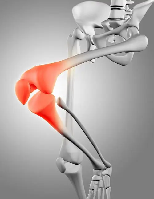 cirugia de rodilla en CDMX