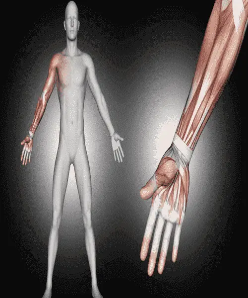 Reparación de fracturas