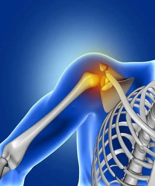 cirugia de rodilla en CDMX
