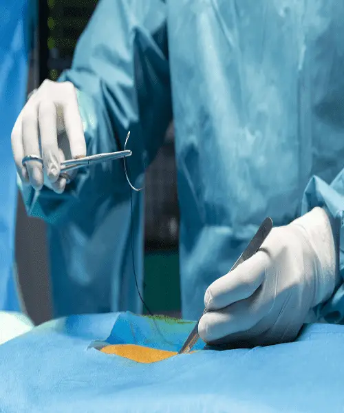 Reparación de fracturas